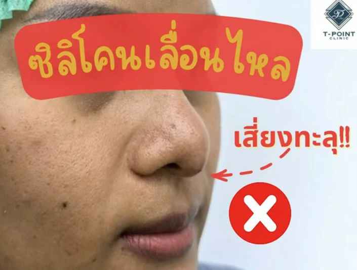 แก้จมูก เชียงใหม่