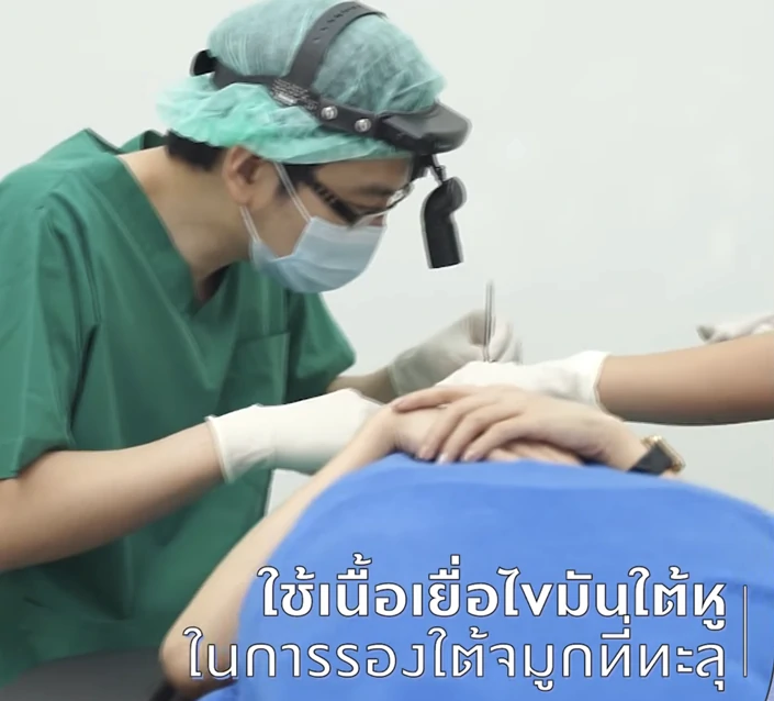 แก้จมูกทะลุเชียงใหม่